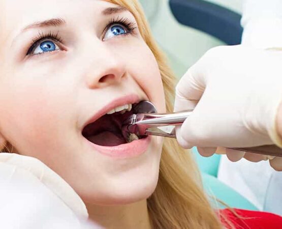 Why Should Wisdom Teeth Be Removed?